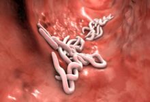 تحقیق در مورد کرم بیماری زا